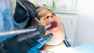 Zahnzusatzversicherung Füllungen