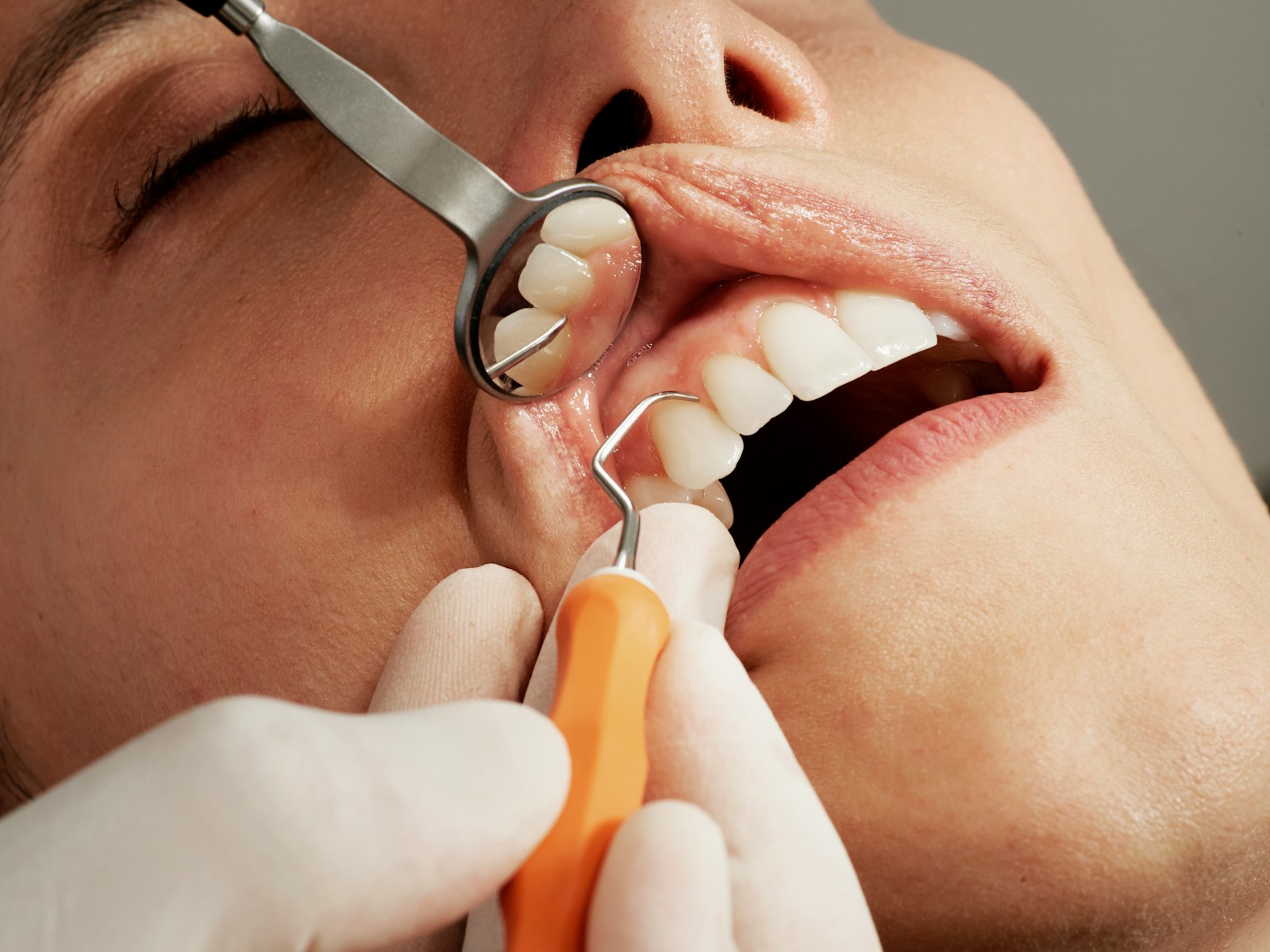 Zahnzusatzversicherung Zahnreinigung