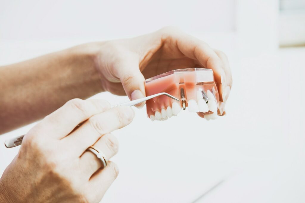 Zahnzusatzversicherung Implantat