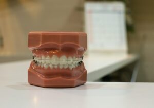 Zahnzusatzversicherung Kieferorthopädie